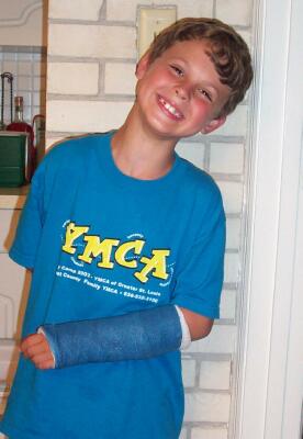 Sam with a Cast